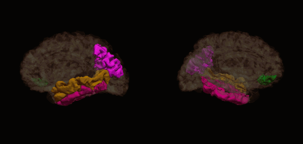 brain_regions - Copy (2).png brain_regions - Copy (2).png